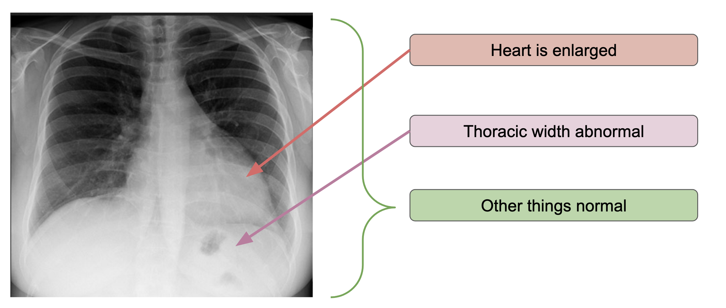 Structured EHR Diagram